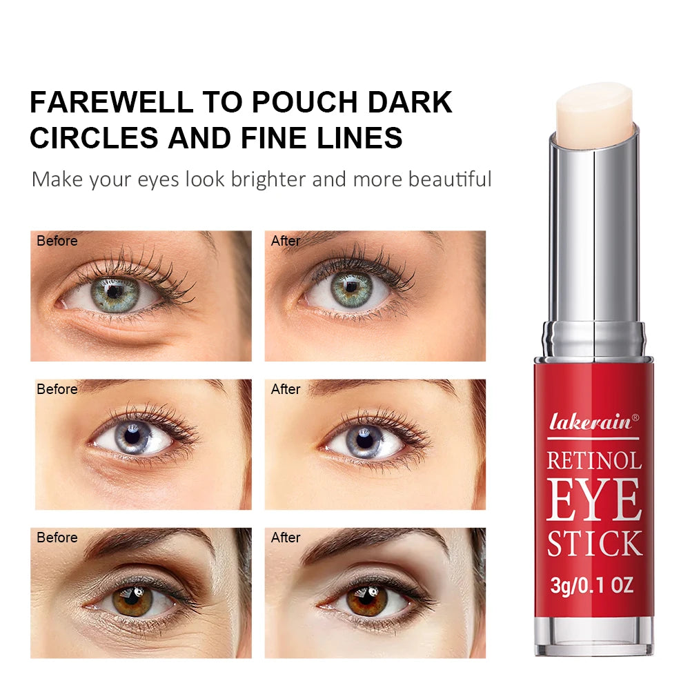 Crema de ojos con retinol para aclarar ojeras y reafirmar la piel. Sérum reparador instantáneo para el contorno de ojos para mujeres. Cuidado de los ojos femeninos.