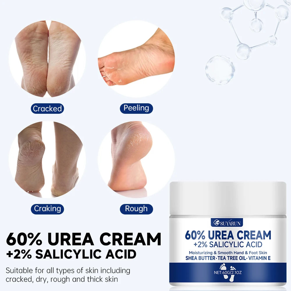 Crema para pies SUYARUN con 60 % de urea para talones agrietados y piel seca: tratamiento hidratante intensivo, removedor de callos, cuidado del pie diabético.