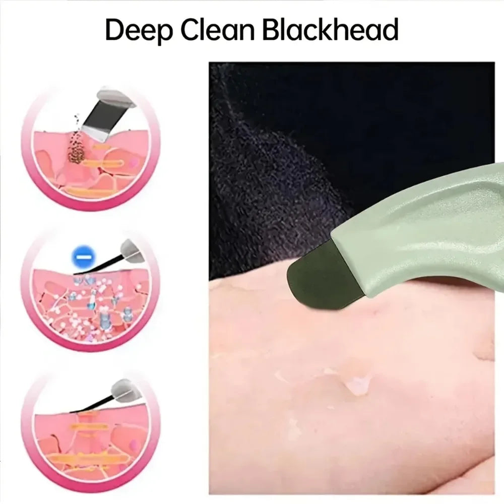 Herramienta para eliminar puntos negros y espinillas en la nariz y el rostro - Limpiador de poros y herramientas para el cuidado de la piel para mujeres