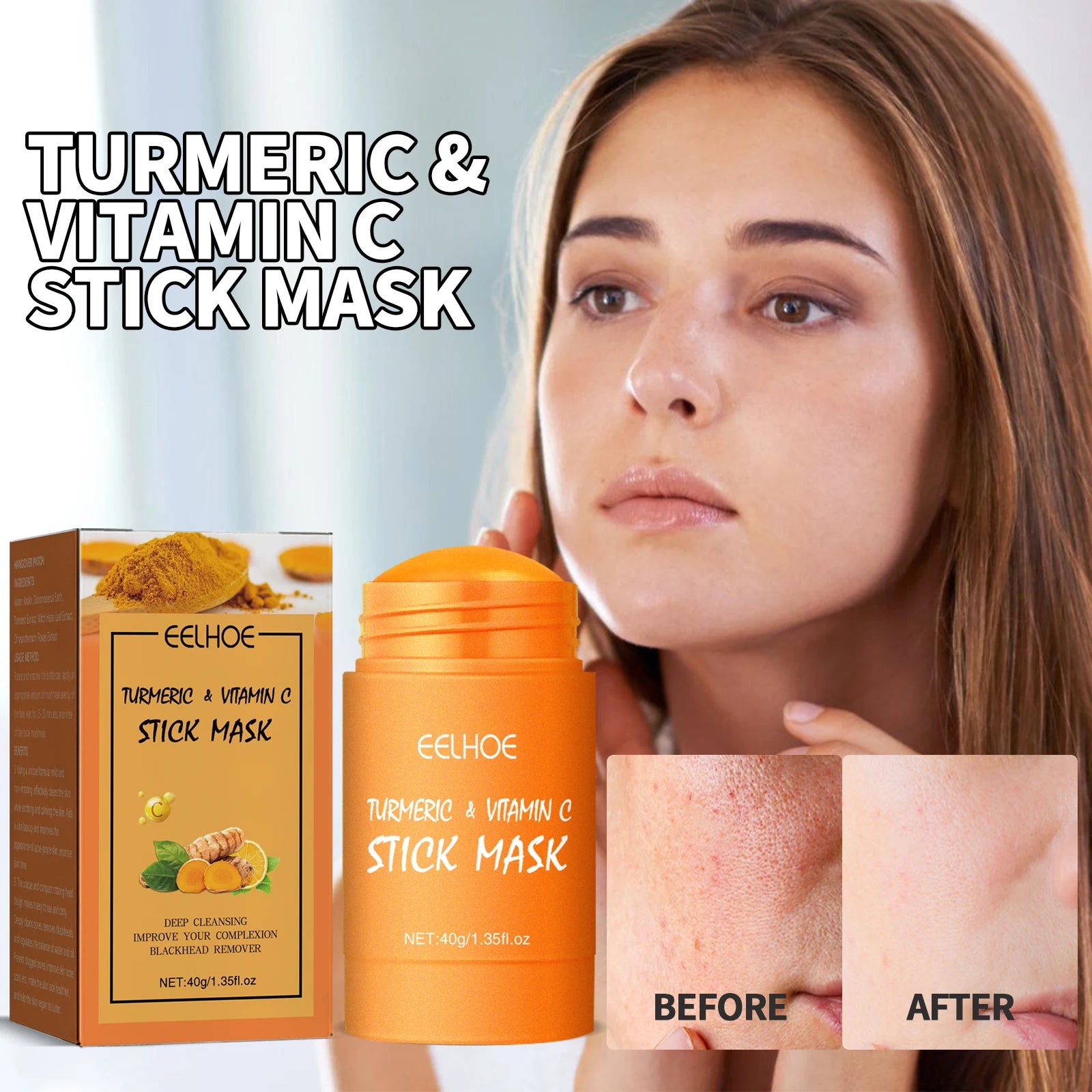 EELHOE Crema facial, sérum, aceite, mascarilla corporal, blanqueadora, antiacné, aclara manchas oscuras e hidratante.