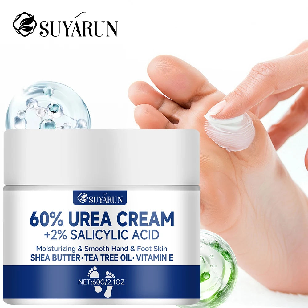 Crema para pies SUYARUN con 60 % de urea para talones agrietados y piel seca: tratamiento hidratante intensivo, removedor de callos, cuidado del pie diabético.