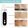 STELLAR - 5-Function EMS Lifting Exfoliator - Ultrasound & Photon Treatment-10