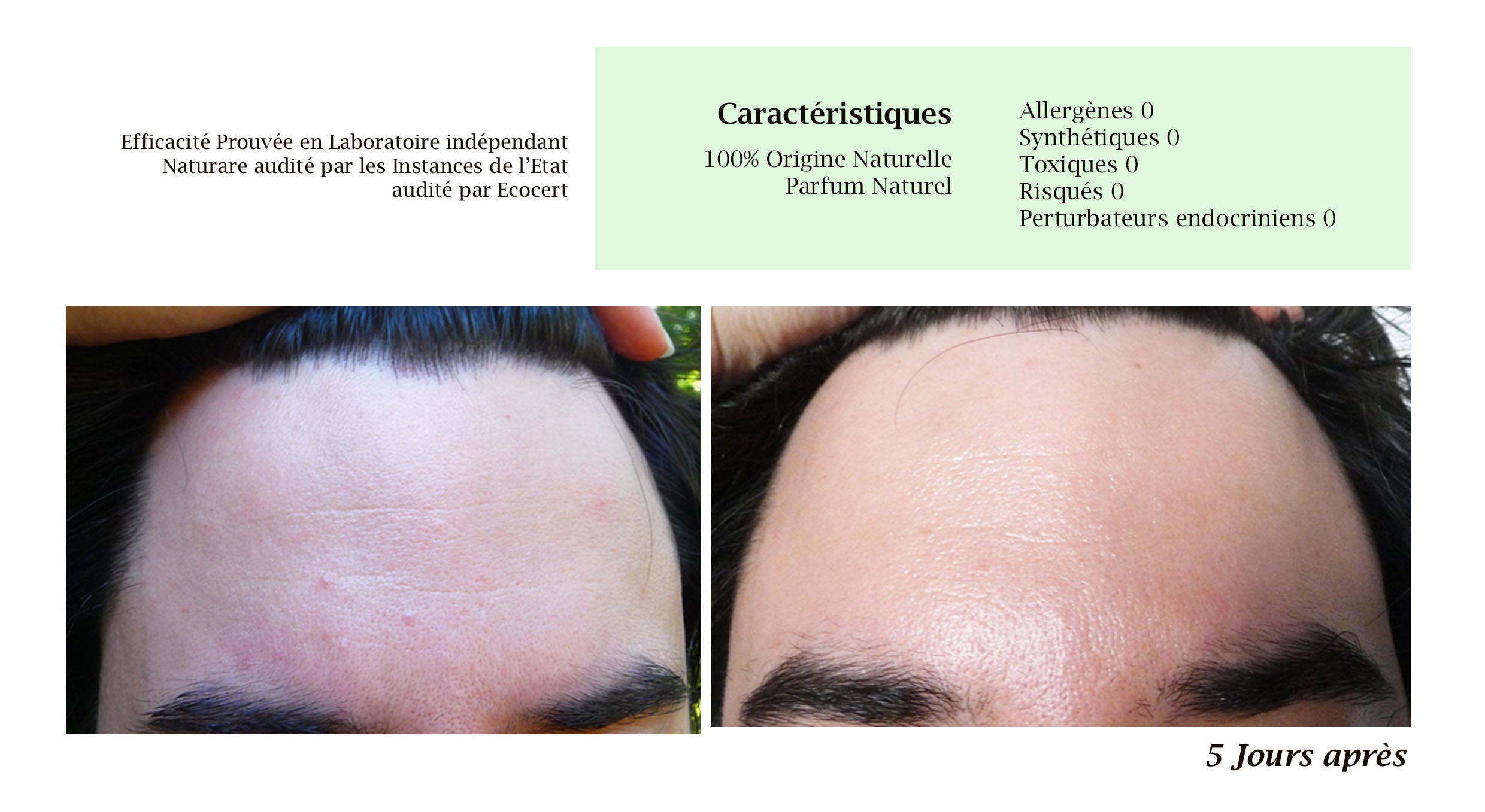 DROP - MERVEILLE DES LANDES ORGANIC - Sensitive Skin Care Complete Regeneration-12